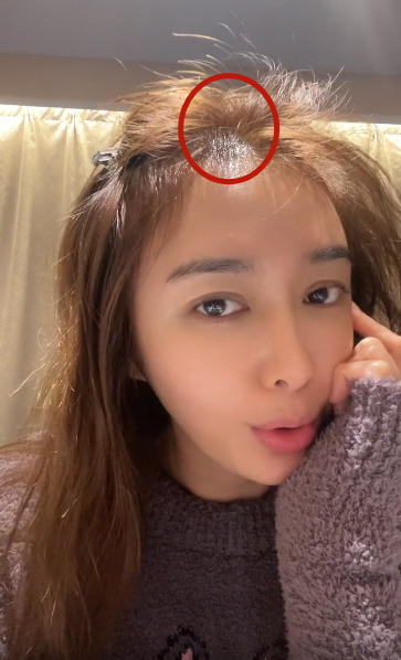 秃顶图片(女明星也有秃头危机) - 赤虎壹号