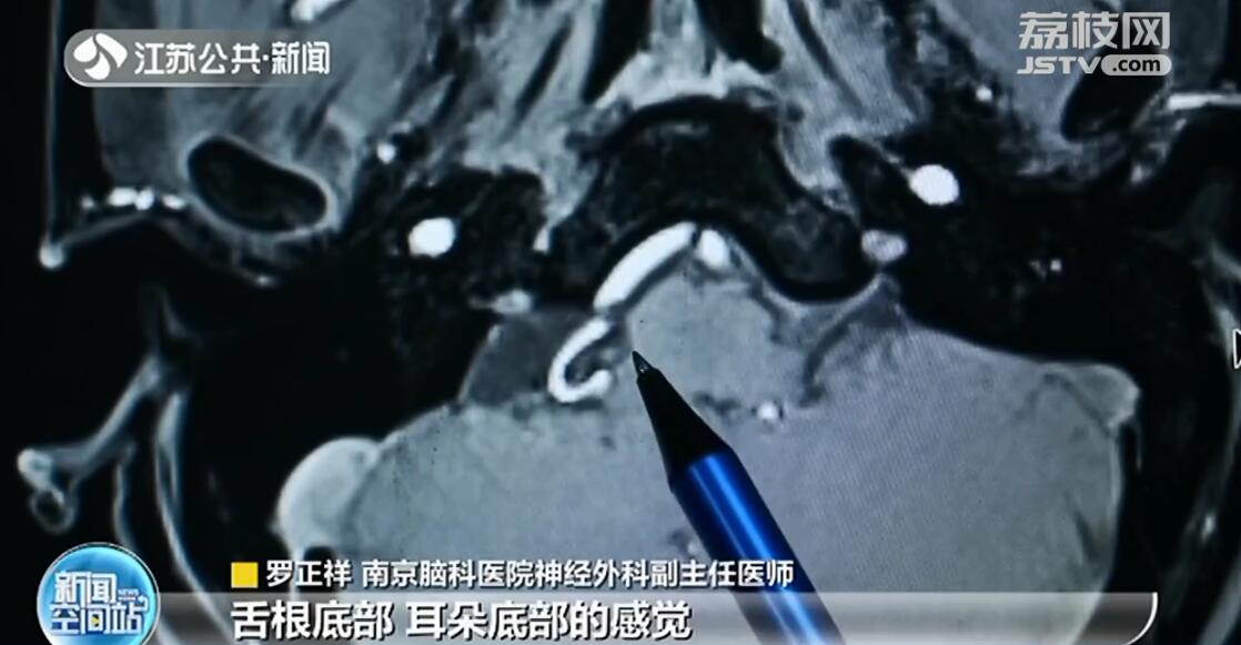 吃饭喝水像吞刀片一样疼！病因竟是脑部神经&ldquo;短路&rdquo;