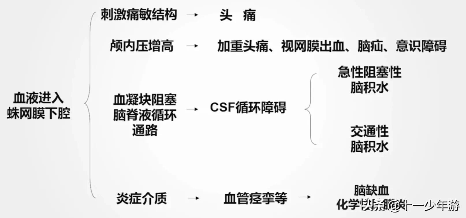 蛛网膜下腔出血