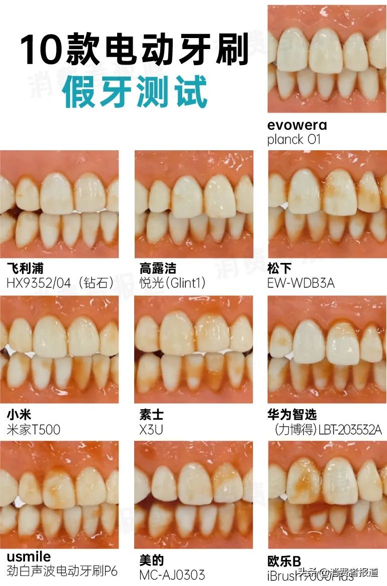 10款电动牙刷对比报告：1000元与100元差距在哪儿？消费者该怎么选？