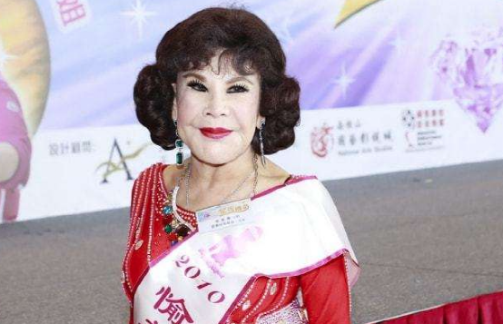 “畸形脸、电风扇脸”，10位整容过度的女星，有人直接命丧手术台