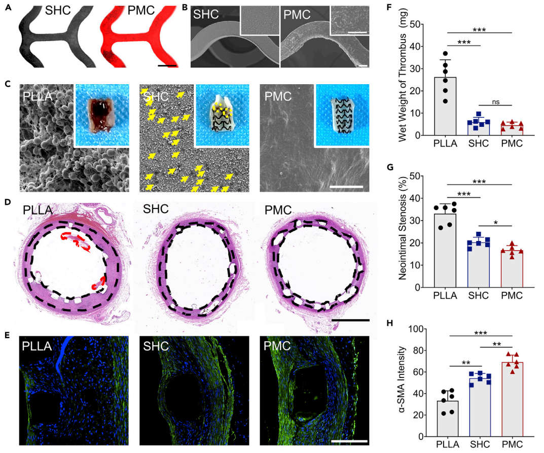 四川大学团队制备出血小板膜涂层植入器械，可避免免疫系统攻击
