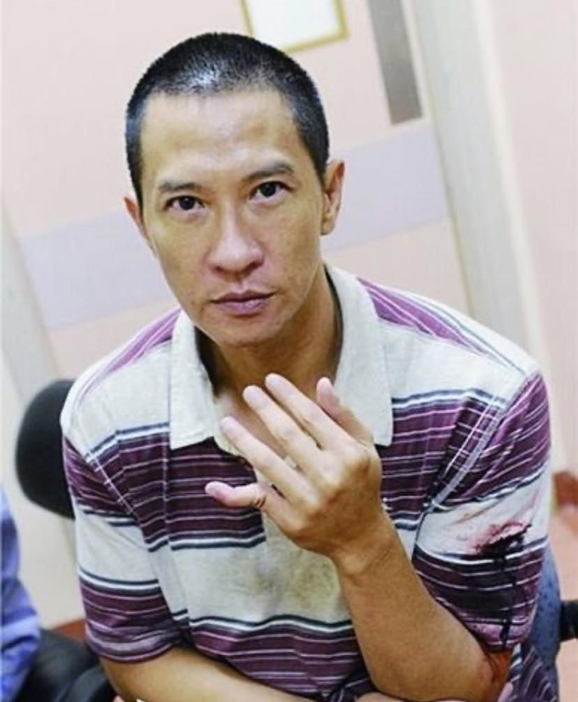 影帝影后多敬业？有人生吞12枚鸡蛋、鼻子被打歪，有人为戏锯门牙