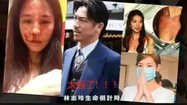 永远记得你们(婚后3年，48岁林志玲近况曝光：这张脸，却被嘲认不出…)