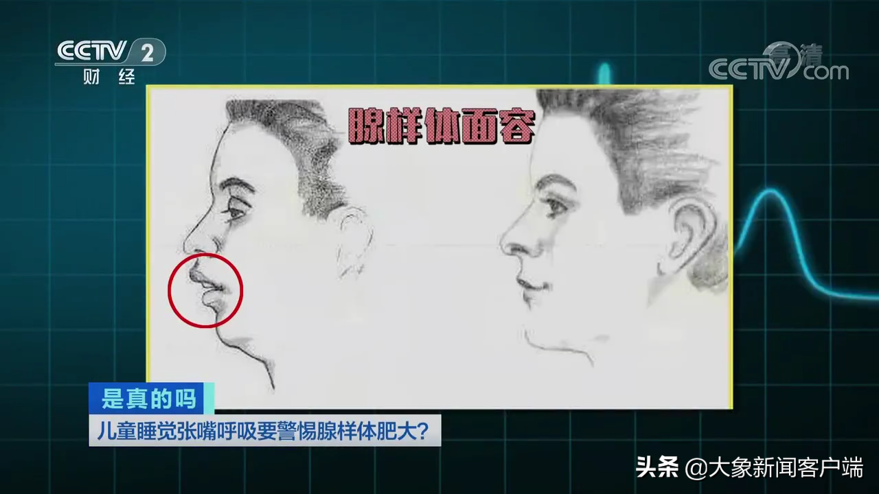 爱呼吸(常州一家长用“封口贴”矫正孩子口呼吸？乱矫正或致孩子窒息)