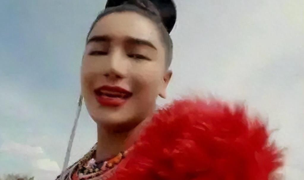 曾是超女冠军,却因整容失败像“怪物”,全身只剩下眼珠是自己的
