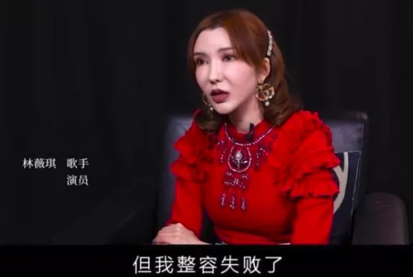 变丑遭前男友嫌弃,为变美却断送前程,女星整容翻车实在太惨