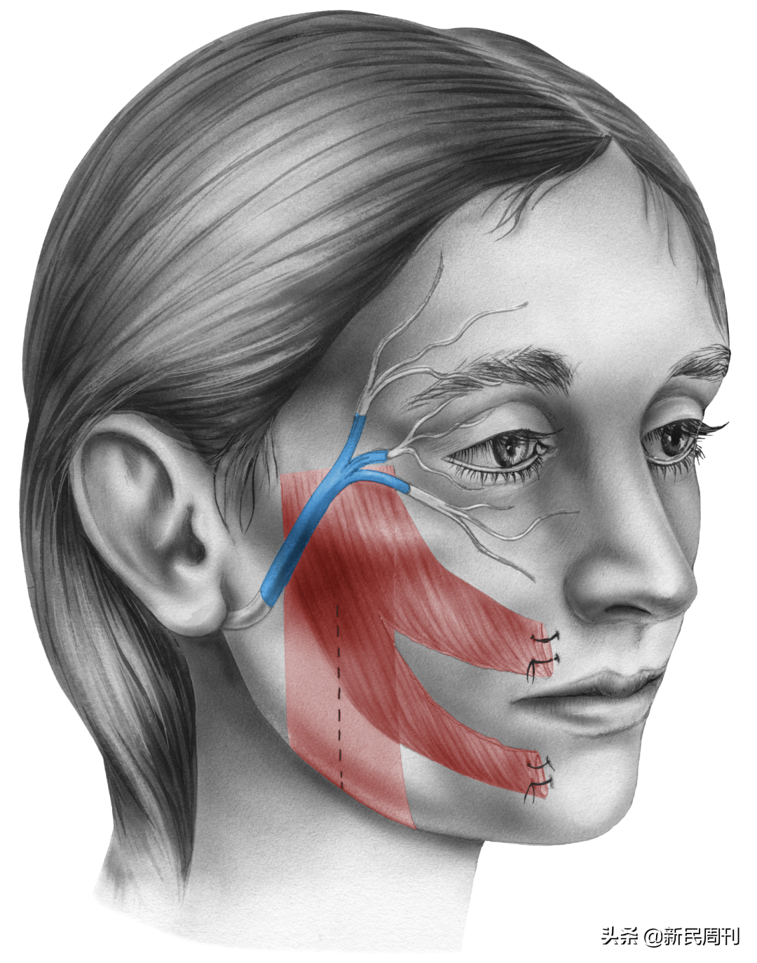 良医 | 比伯面瘫，这么好看的脸还能治好吗？