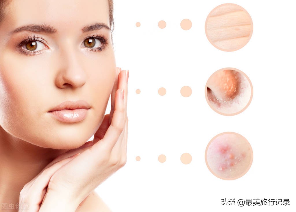 隆力奇：爽肤水的正确使用方法