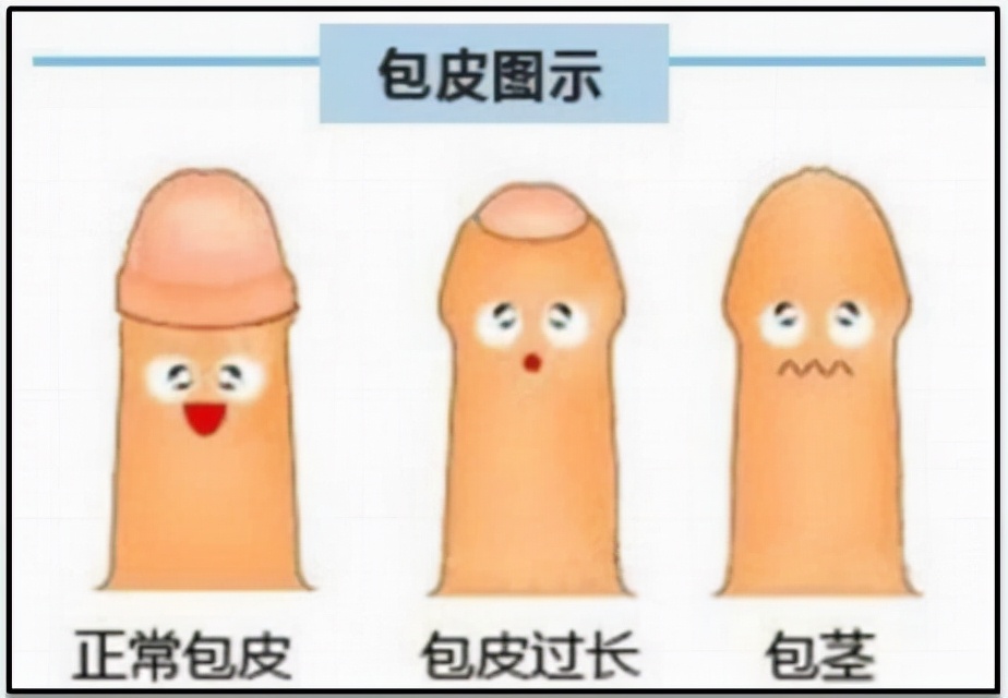 男性生殖健康问题及保健-阴茎与前列腺