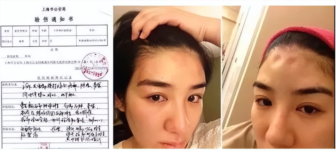 这10位女星，都曾是上戏校花，如今有人整容、有人被家暴