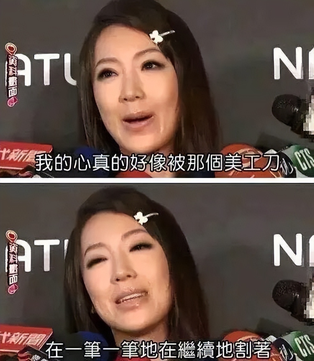 王心凌：被3任前男友坑了又坑，又深陷整容疑云，她的人生真坎坷