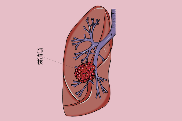 男性夜间盗汗，是病吗？严不严重？该怎么调理？听听怎么说