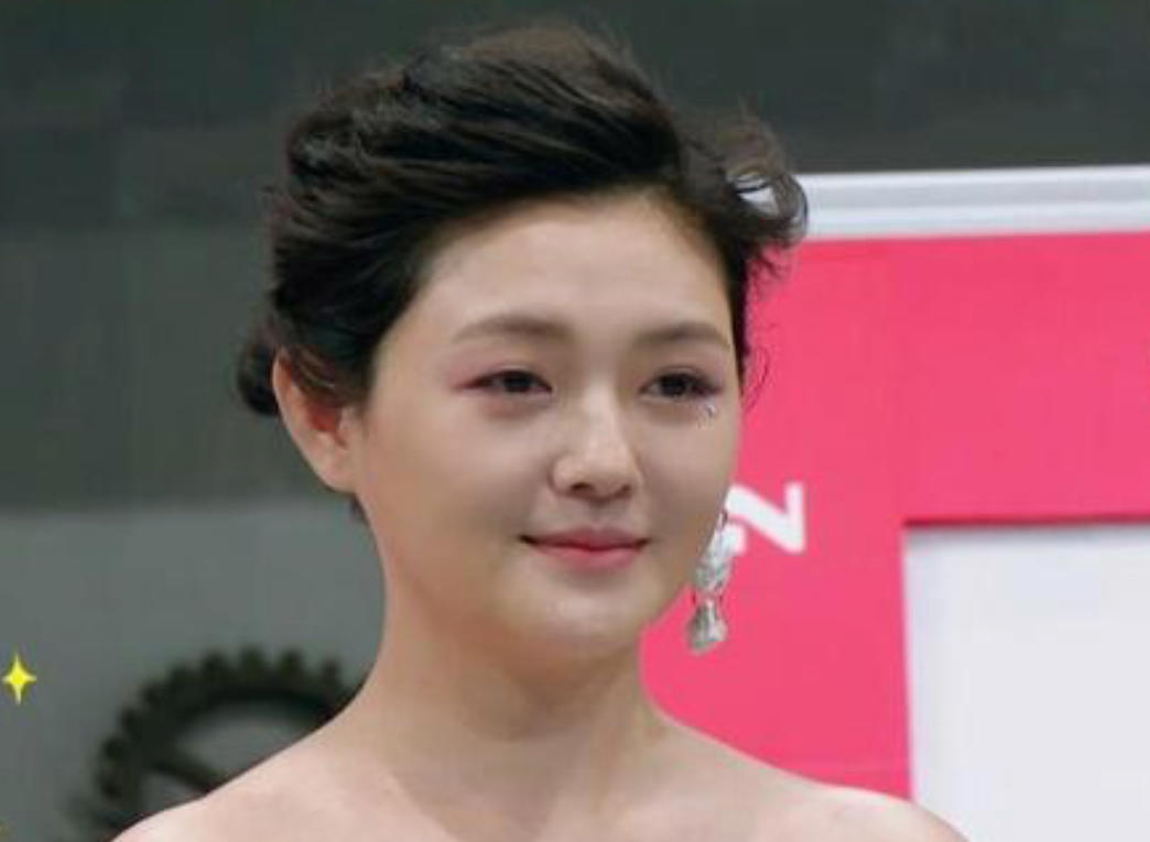 脸部肿成“馒头”，笑起来秒变“僵尸”，这些明星的脸到底咋了？