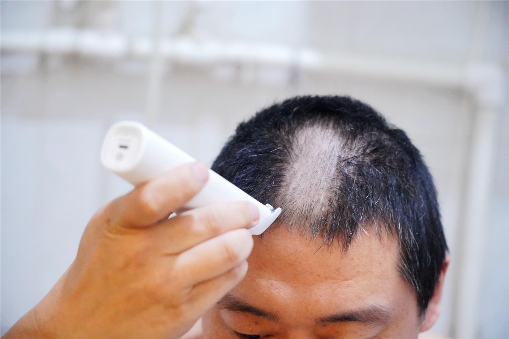 售价99元，比小米的同类产品还具性价比，这一次飞科赢了