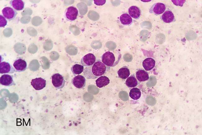 肝病患者为什么会出现腹水？有三个因素，中西医治疗有哪些不同？