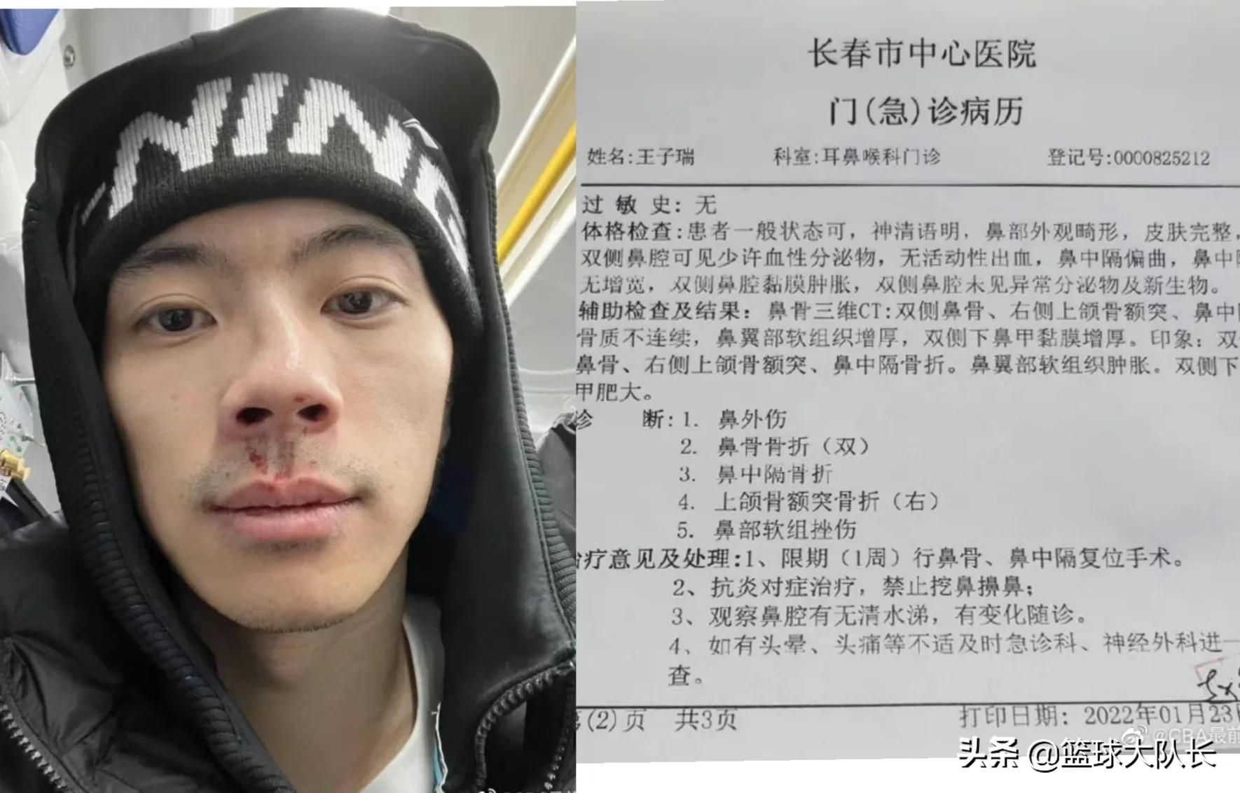 王子睿cba个人资料（CBA3消息！广东垫脚伤威尔斯，王子睿鼻子骨折，马布里再生事端）