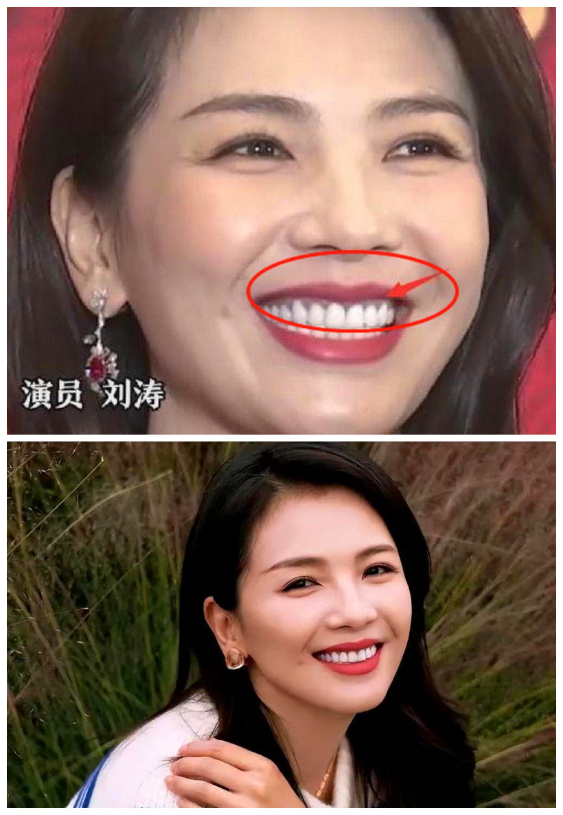 刘涛和男演员拍吻戏,王珂:悠着点嘬,她这一口假牙花了300万