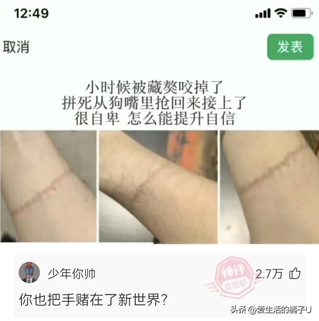 神回复：听我的拿高锰酸钾原液洗见效更快