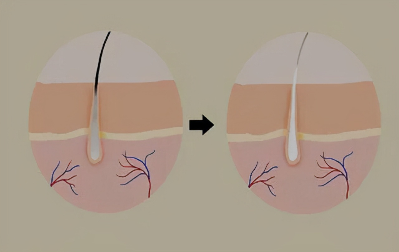 “鼻毛变白”是衰老的信号吗？或许还有其他原因，男性需警惕