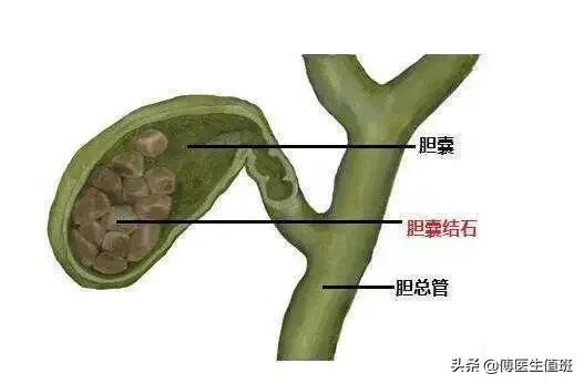 30分钟的手术，作了两个小时，医生：以后这样的病人会越来越多