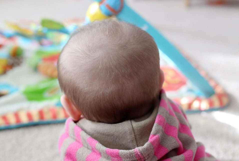刚出生的婴儿头发图片