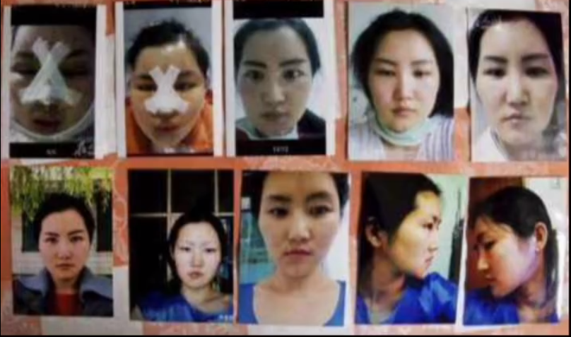8年前，这个中国姑娘去韩国整容后，她的人生差点被毁掉
