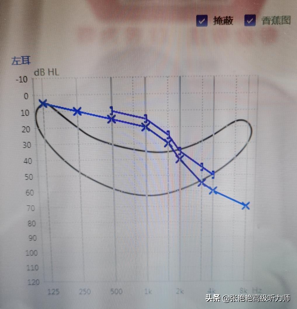 小声说话听不清是神经性耳聋吗？ - 多环保