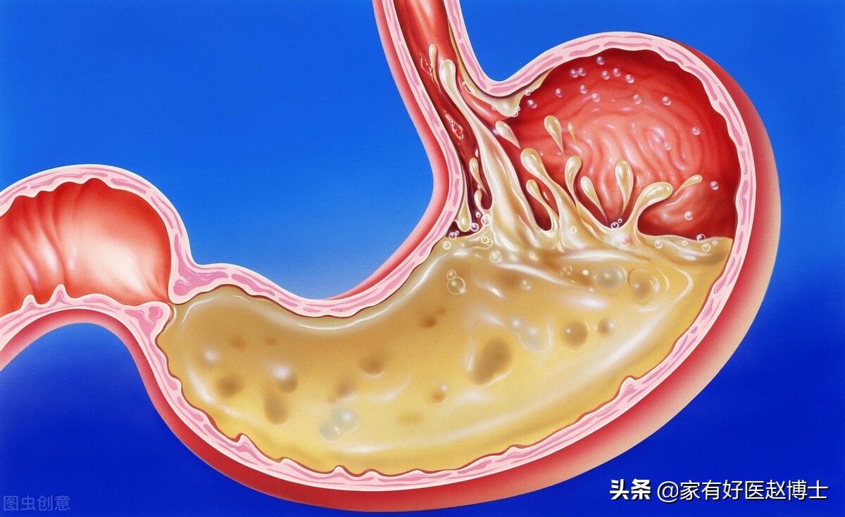 想一次就把幽门螺杆菌给除干净，除菌前您需要了解的3个要点