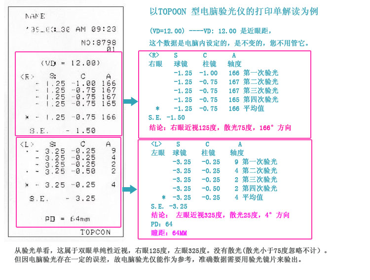 线上配眼镜全流程攻略，镜片防伪教程