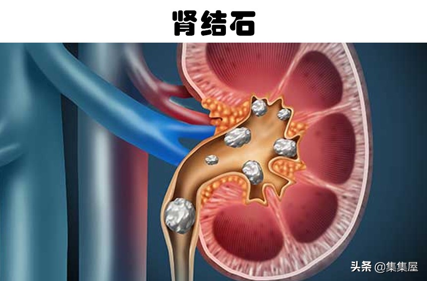 全球最痛苦的十大手术排名，眼睛灼伤疼痛程度令人难以想象