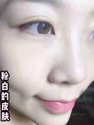 甘油白醋能美白吗（最经济的美白方法介绍）