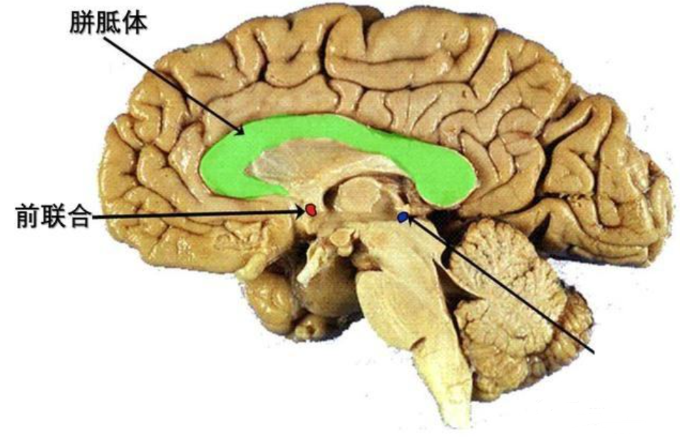 胼胝体在脑中的位置而我们惯用手的使用也在影响着该区域的变化发展