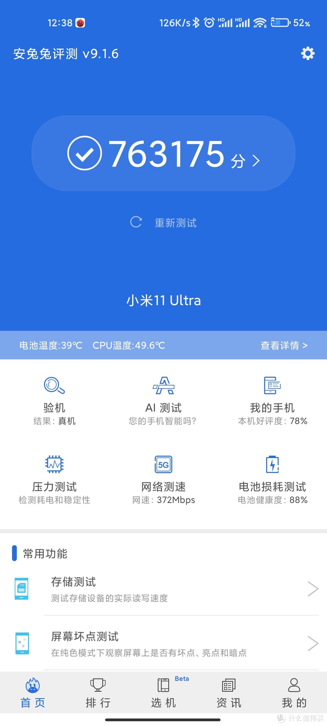 从首发到现在的小米11Ultra经历了什么：体验分享（长文警告！）