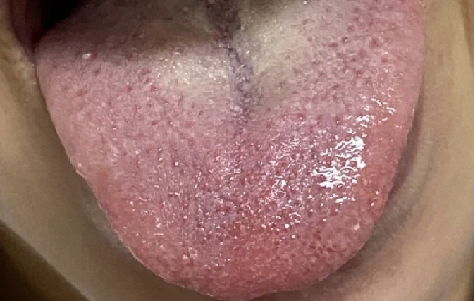 如果你平时总是觉得心里面烦躁,非常难以入睡,就算睡着了,也是不停