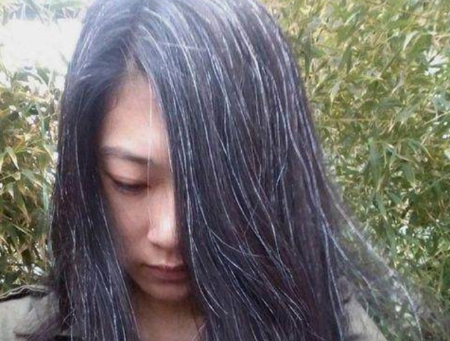 女性白头发日渐增多,别以为自己老了,也可能是因为缺乏3种营养