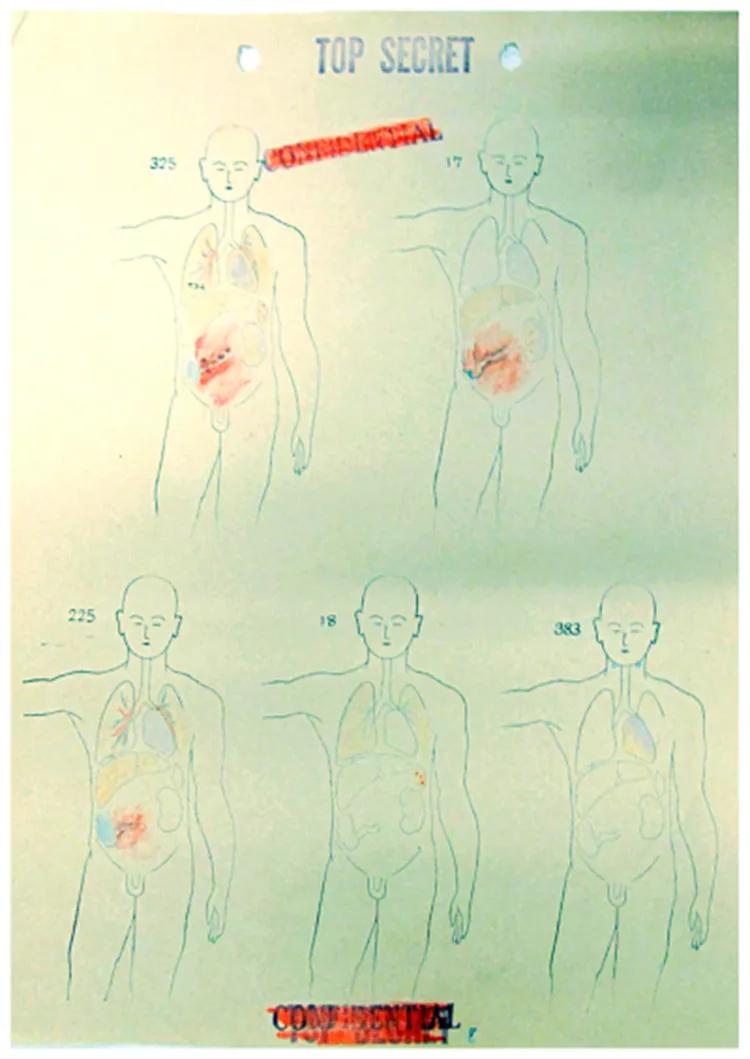 细菌的人工培养实验报告（细菌的人工培养法实验报告）-第7张图片-科灵网