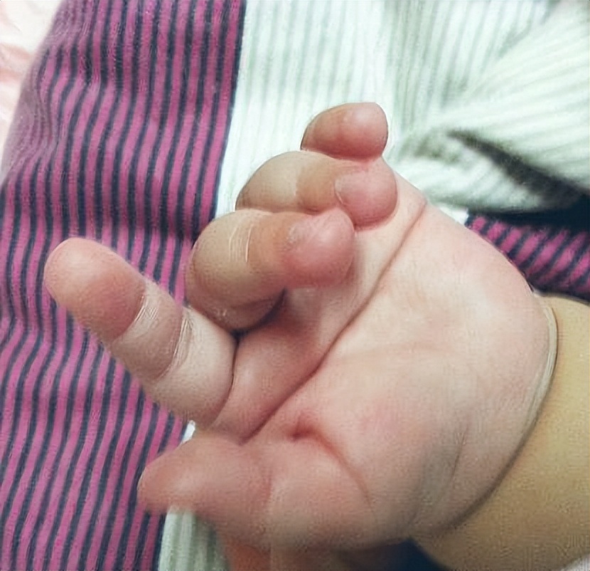 小宝宝手掌有“横纹”，代表智力有问题？来看看关于掌纹的秘密