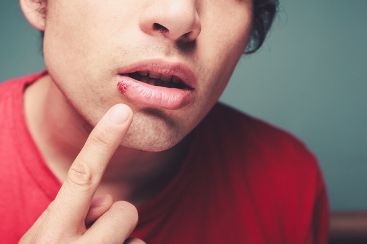 黑唇怎么办(嘴唇颜色可以反映健康问题？嘴巴出现3个异常，警惕是疾病信号)