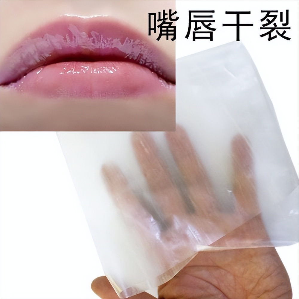 嘴唇干裂脫皮怎么辦（嘴唇干裂脫皮怎么快速恢復(fù)）