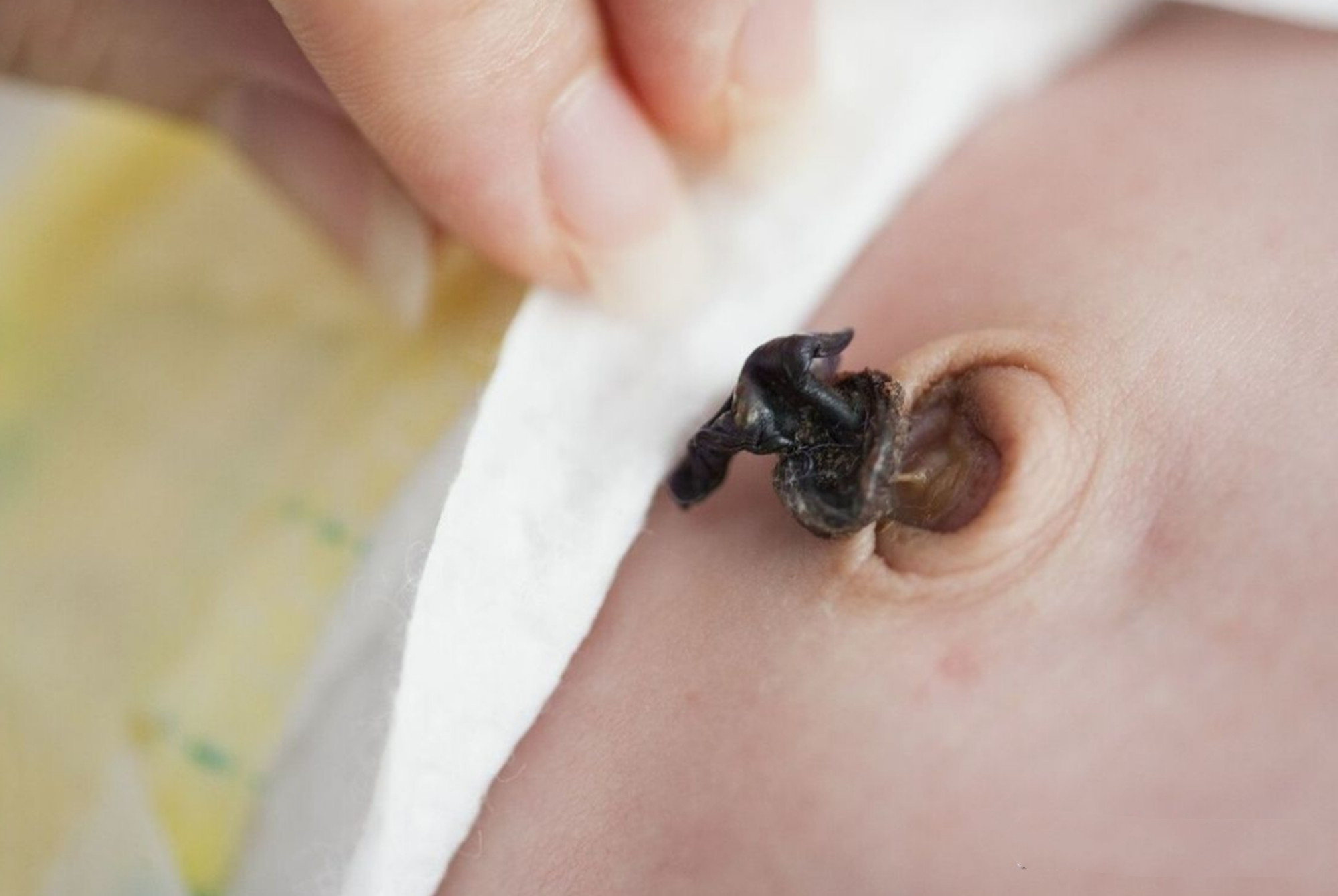 宝宝肚脐眼的"泥"又黑又脏,宝妈千万别乱抠,五步教你科学清理