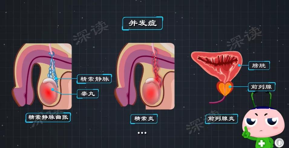 男生的蛋碎了到底有多痛(蛋蛋又痛又肿还发烧？小伙长期熬夜突发睾丸炎？这些症状要小心)