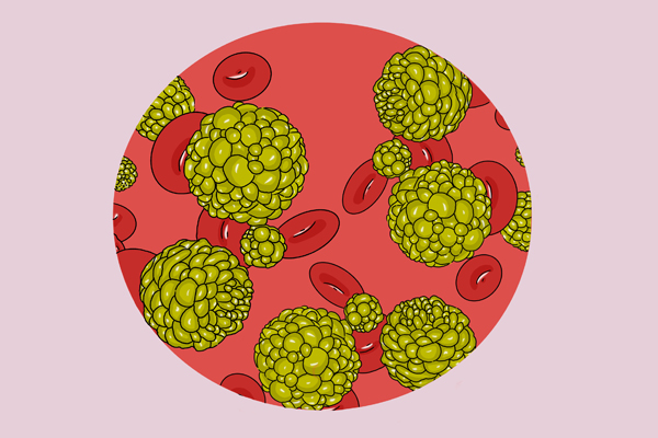 备受争议的3种“癌”不致命，不建议过度治疗，假如你有，别紧张