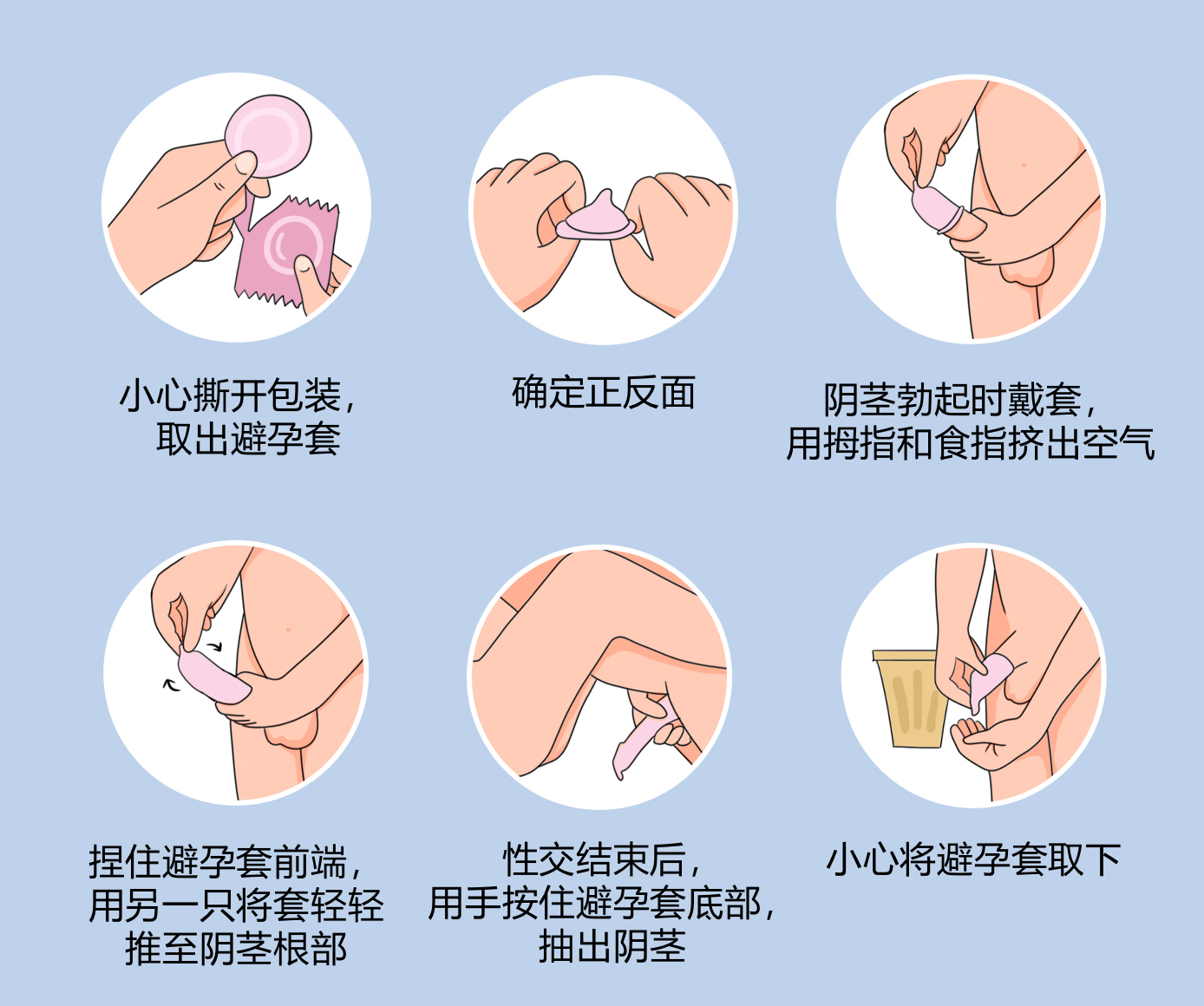 避孕套是一种避孕成功率较高,使用较方便且普及较广泛的避孕方法
