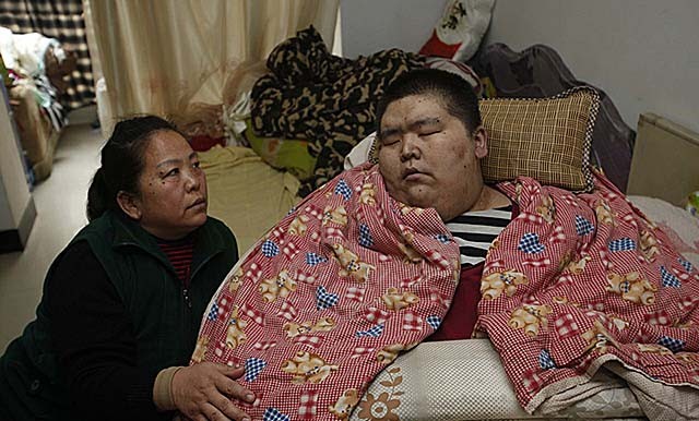 河北小伙胸口顶着200多斤肉球，体重500斤，吃喝拉撒在床上解决