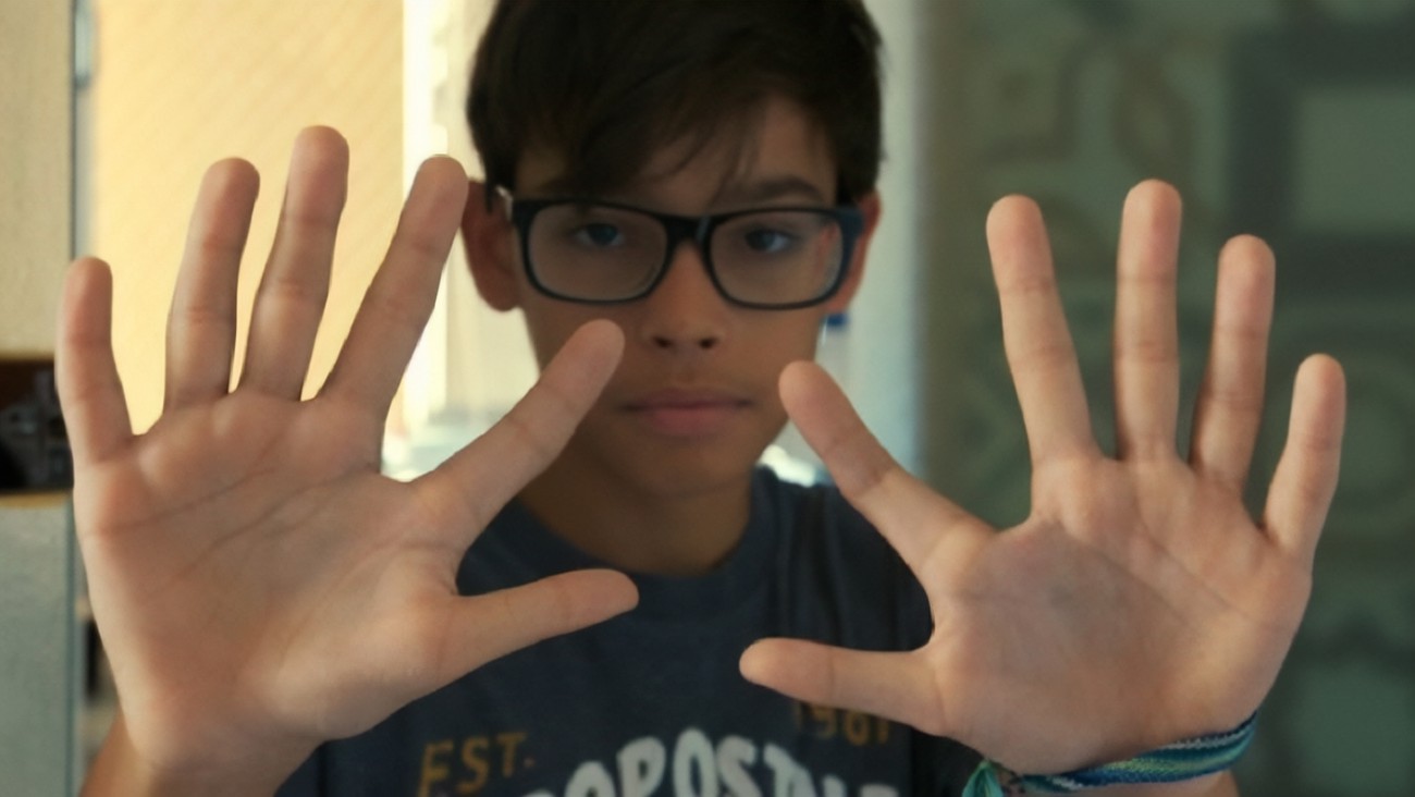 六指图片(巴西家族为自己有十二根手指感到自豪) - 赤虎壹号