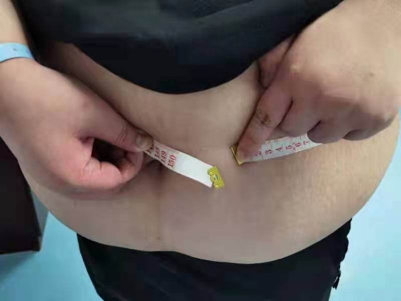 这个孩子16岁360多斤！少儿肥胖已成为中国重要公共卫生问题