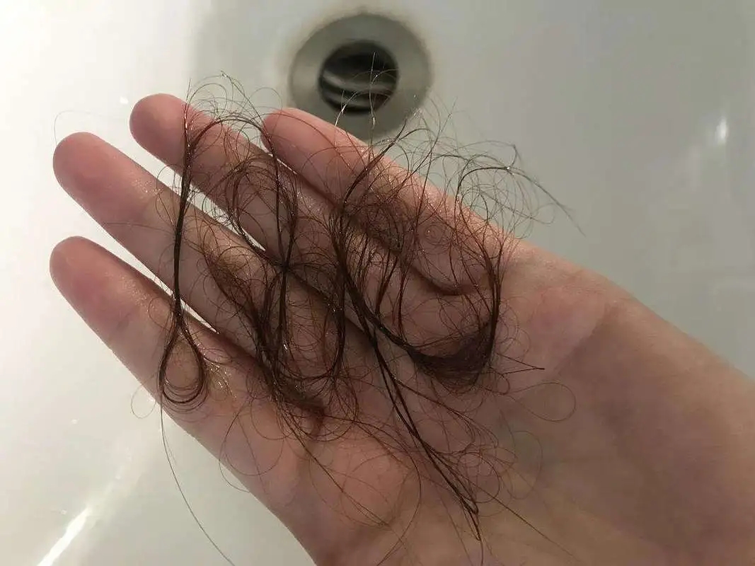 而是一直处在一个更新周期中,每天都会有头发会自然脱落,但相对应的