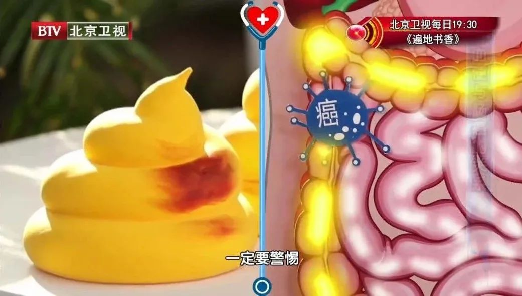 大便粘马桶,是"湿气太重"?伴随着这些症状,可能生大病了