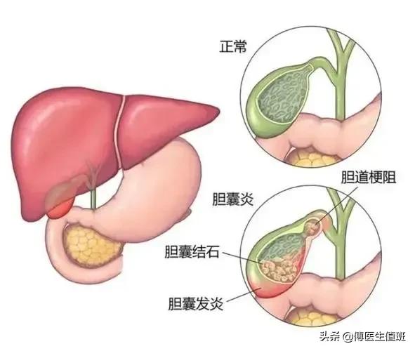 30分钟的手术，作了两个小时，医生：以后这样的病人会越来越多